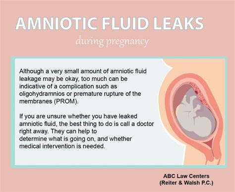 amniotic.fluid leaking|Water Breaking: What Are the Signs of Leaking。